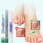 orivelle nail fungus pen main product image