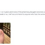 Orivelle Anti-Fungal Pen Review: Does It Really Work for Nail Fungus?